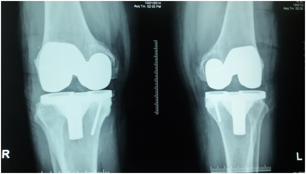 x-ray